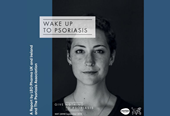 Wake Up to Psoriasis